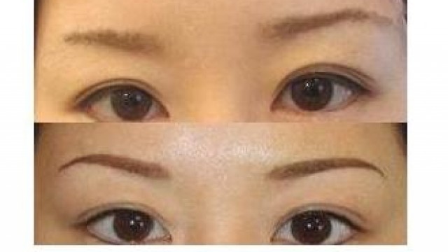 目元の印象を変えてみませんか？